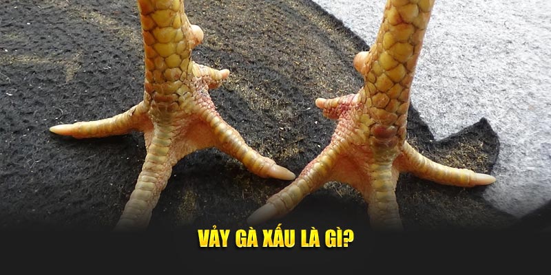 Vảy gà xấu là gì?